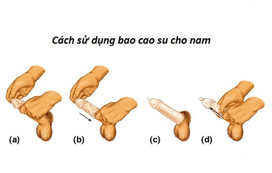 Cach Deo Bao Cao Su 1 • Shopvochong24h